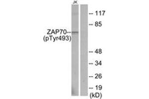 Western blot analysis of extracts from Jurkat cells, using ZAP-70 (Phospho-Tyr493) Antibody. (ZAP70 抗体  (pTyr493))