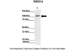 Lanes:   Lane 1: 50ug Hela Lysate  Primary Antibody Dilution:   1:1000  Secondary Antibody:   Anti-rabbit-HRP  Secondary Antibody Dilution:   1:10,000  Gene Name:   RBM14  Submitted by:   Archa Fox, University of Western Australia (RBM14 抗体  (N-Term))