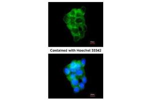 ICC/IF Image Immunofluorescence analysis of methanol-fixed A431, using PPFIBP2, antibody at 1:200 dilution. (PPFIBP2 抗体  (Center))