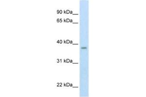 Western Blotting (WB) image for anti-Zinc Finger, MYND-Type Containing 11 (ZMYND11) antibody (ABIN2461027)