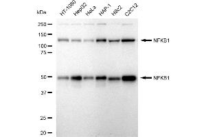 Western blotting analysis using NFKB1 antibody (ABIN7799638).