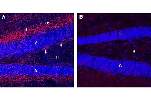 Expression of Cannabinoid Receptor 1 in mouse hippocampus. (Cannabinoid Receptor 1 (CNR1) Peptide)