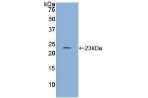 Detection of Recombinant RGS4, Human using Polyclonal Antibody to Regulator Of G Protein Signaling 4 (RGS4) (RGS4 抗体  (AA 38-205))