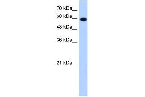 WB Suggested Anti-STIP1 Antibody Titration:  1. (STIP1 抗体  (C-Term))