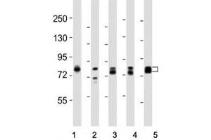 Western blot testing of DNM1L antibody at 1:8000 dilution and lysate from: 1: rat PC12; 2: human skeletal muscle; 3: HeLa; 4: mouse NIH3T3; 5: LNCaP; Predicted molecular weight is 82 kDa. (Dynamin 1-Like 抗体  (C-Term))