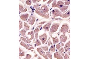 A staining MYBPC3 in human heart tissue sections by Immunohistochemistry (IHC-P - paraformaldehyde-fixed, paraffin-embedded sections). (MYBPC3 抗体  (N-Term))