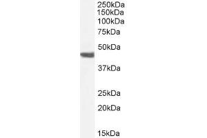 Western Blotting (WB) image for anti-Actin, alpha 2, Smooth Muscle, Aorta (ACTA2) (N-Term) antibody (ABIN185271)