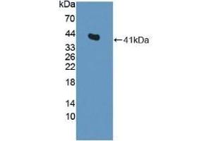 Detection of Recombinant CENTa2, Rat using Polyclonal Antibody to Centaurin Alpha 2 (CENTa2) (ADAP2 抗体  (AA 49-360))