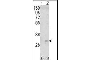 Western blot analysis of ITM2A (arrow) using rabbit polyclonal ITM2A Antibody (N-term) (ABIN390731 and ABIN2841002). (ITM2A 抗体  (N-Term))