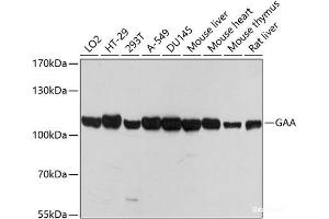 Western blot analysis of extracts of various cell lines using GAA Polyclonal Antibody at dilution of 1:1000. (GAA 抗体)