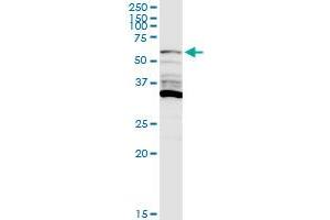Western Blotting (WB) image for anti-Phosphatidylinositol-4-Phosphate 5-Kinase, Type I, alpha (PIP5K1A) (AA 1-500) antibody (ABIN948678)
