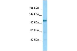 WB Suggested Anti-Diaph2 Antibody Titration: 1. (DIAPH2 抗体  (C-Term))