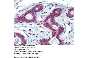 Immunohistochemistry with Human Breast tissue at an antibody concentration of 5. (FUBP1 抗体  (Middle Region))