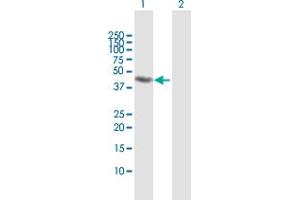 Western Blot analysis of RNF113B expression in transfected 293T cell line by RNF113B MaxPab polyclonal antibody. (RNF113B 抗体  (AA 1-322))