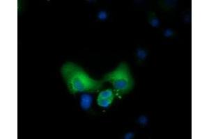 Anti-CBWD1 mouse monoclonal antibody (ABIN2452879) immunofluorescent staining of COS7 cells transiently transfected by pCMV6-ENTRY CBWD1 (RC222790). (CBWD1 抗体)