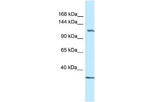 WB Suggested Anti-Zbtb38 Antibody   Titration: 1. (ZBTB38 抗体  (C-Term))