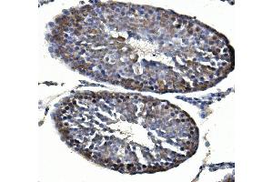 IHC analysis of Inhibin alpha/INHA using anti-Inhibin alpha/INHA antibody (ABIN7600932). (Inhibin alpha 抗体  (AA 254-366))
