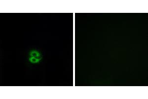 Peptide - +Immunofluorescence analysis of A549 cells, using CHST6 antibody. (CHST6 抗体)