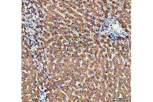 IHC analysis of ALDH1A3 using anti-ALDH1A3 antibody (ABIN5518802).