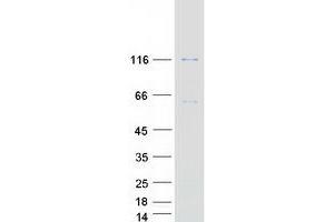 Western Blotting (WB) image for Caspase Recruitment Domain Family, Member 14 (CARD14) (Transcript Variant 1) protein (Myc-DYKDDDDK Tag) (ABIN2713160)