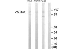 Western blot analysis of extracts from HepG2/HeLa/HuvEc cells, using Actinin alpha-2/3 Antibody. (ACTN2/3 抗体  (AA 31-80))