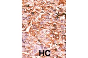 Immunohistochemistry (IHC) image for anti-HIST1H3B3 (pSer10) antibody (ABIN2933004) (HIST1H3B3 (pSer10) 抗体)
