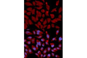 Immunofluorescence analysis of U2OS cells using DNMT3A antibody (ABIN5971096). (DNMT3A 抗体)