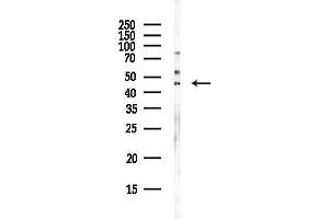 anti-Chromosome 22 Open Reading Frame 9 (C22orf9) antibody