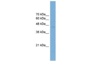 WB Suggested Anti-ARFGAP1 Antibody Titration: 0. (ARFGAP1 抗体  (Middle Region))