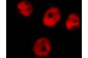 ABIN6266649 staining A549 by IF/ICC. (UBR5 抗体  (N-Term))