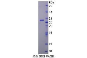 SDS-PAGE (SDS) image for Vasorin (Vasn) (AA 298-539) protein (His tag) (ABIN3209959) (Vasn Protein (AA 298-539) (His tag))