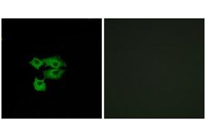 Immunofluorescence analysis of A549 cells, using LY6E antibody. (LY6E 抗体  (Internal Region))