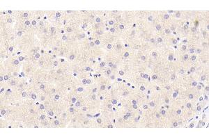 Detection of F2 in Human Liver Tissue using Monoclonal Antibody to Coagulation Factor II (F2) (Prothrombin 抗体)