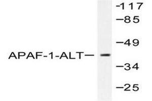 Image no. 2 for anti-Apoptotic Peptidase Activating Factor 1 (APAF1) antibody (ABIN265312) (APAF1 抗体)