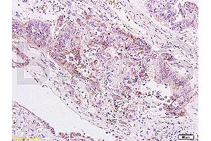 Immunohistochemistry (IHC) image for anti-V-Set Domain Containing T Cell Activation Inhibitor 1 (VTCN1) (AA 50-100) antibody (ABIN671736)