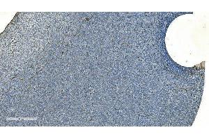 IHC analysis of H Cadherin/CDH13 using anti-H Cadherin/CDH13 antibody (ABIN7600095). (Cadherin 13 抗体  (AA 149-692))