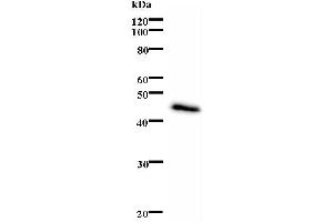Western Blotting (WB) image for anti-Excision Repair Cross-Complementing Rodent Repair Deficiency, Complementation Group 6 (ERCC6) antibody (ABIN932472) (ERCC6 抗体)