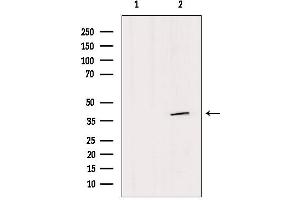 Western blot analysis of extracts from HepG2, using SFXN4 Antibody. (Sideroflexin 4 抗体  (N-Term))
