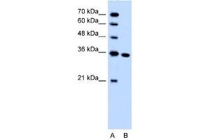 SLC25A29 antibody used at 1. (SLC25A29 抗体  (C-Term))