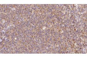 Immunohistochemistry (IHC) image for anti-ATPase, H+ Transporting, Lysosomal 70kDa, V1 Subunit A (ATP6V1A) (C-Term) antibody (ABIN6260133)