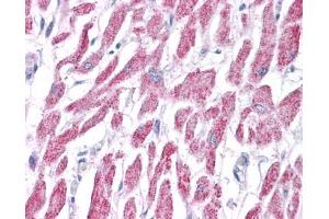 ACAT1 antibody was used for immunohistochemistry at a concentration of 4-8 ug/ml. (ACAT1 抗体  (Middle Region))