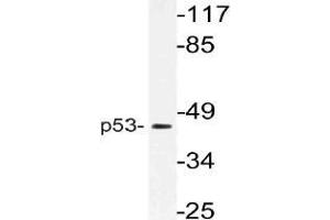 Western blot (WB) analysis of p53 antibody in extracts from 293 cells. (p53 抗体)
