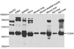 Western blot analysis of extracts of various cell lines, using TEAD4 antibody (ABIN5972288) at 1/1000 dilution. (TEAD4 抗体)