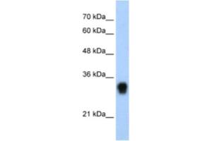 Western Blotting (WB) image for anti-Ribosomal Protein L8 (RPL8) antibody (ABIN2462054) (RPL8 抗体)