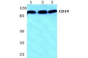 Western Blot analysis of CD19 antibody at 1/500 dilution: Lane 1: MCF-7 cell lysate. (CD19 抗体)