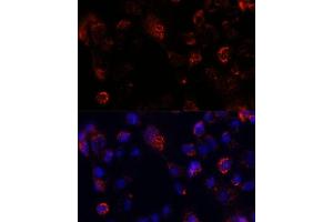 Immunofluorescence analysis of  cells using  antibody (ABIN7265429) at dilution of 1:100. (ACOT9 抗体  (AA 22-250))