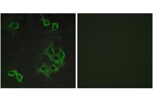 Immunofluorescence analysis of COS7 cells, using CCRL1 Antibody. (CCRL1 抗体  (AA 5-54))