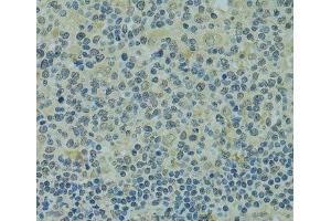 Immunohistochemistry of paraffin-embedded Human tonsil using IVNS1ABP Polyclonal Antibody at dilution of 1:100 (40x lens). (IVNS1ABP 抗体)