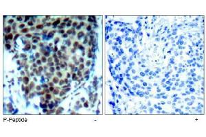Image no. 2 for anti-Mitogen-Activated Protein Kinase 14 (MAPK14) (pThr180) antibody (ABIN197010) (MAPK14 抗体  (pThr180))