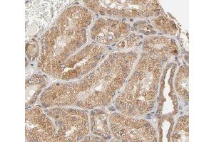 Immunohistochemistry (IHC) image for anti-Protein tyrosine Phosphatase, Non-Receptor Type 11 (PTPN11) (pTyr580) antibody (ABIN6256769)